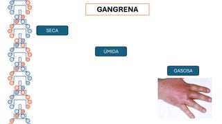 GANGRENA
SECA
ÚMIDA
GASOSA
 