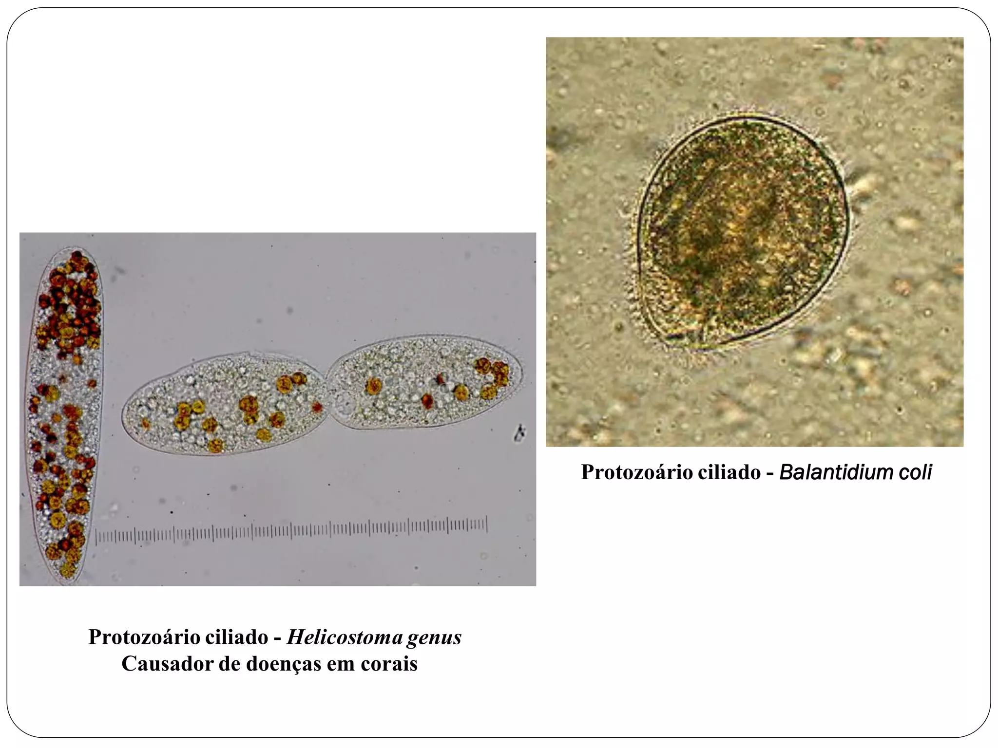 Protozoário ciliado - Helicostoma genus
Causador de doenças em corais
Protozoário ciliado - Balantidium coli
 