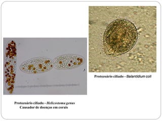 Protozoário ciliado - Helicostoma genus
Causador de doenças em corais
Protozoário ciliado - Balantidium coli
 