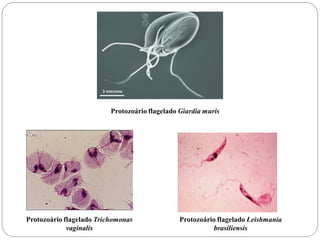 Protozoário flagelado Giardia muris
Protozoário flagelado Trichomonas
vaginalis
Protozoário flagelado Leishmania
brasiliensis
 