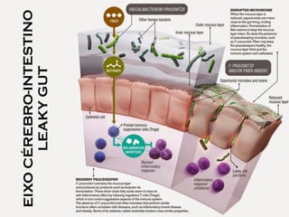EIXOCÉREBRO-INTESTINO 
LEAKYGUT
 