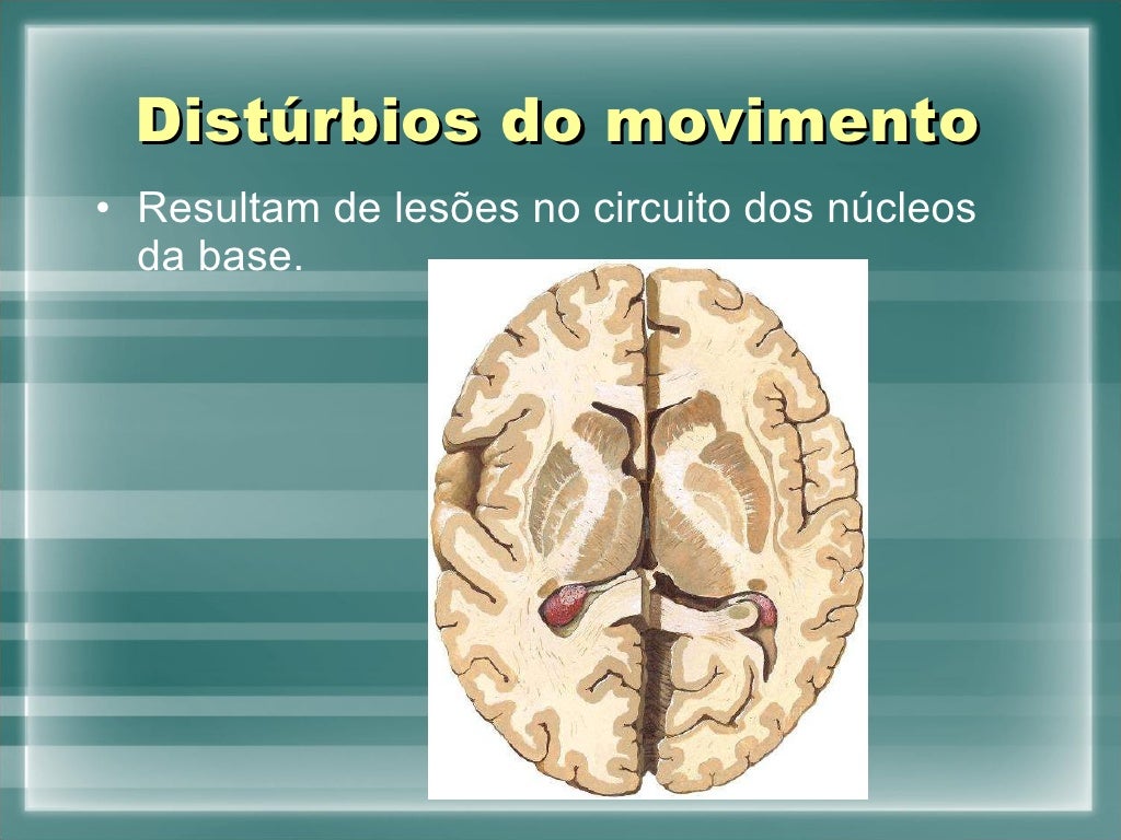 O Que São Espasmos Musculares Involuntários? – PVEUG