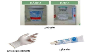 Luvas de procedimento
xylocaína
contraste
 
