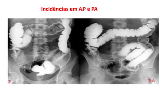 Incidências em AP e PA
 