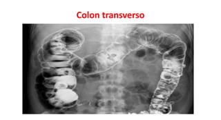 Colon transverso
 