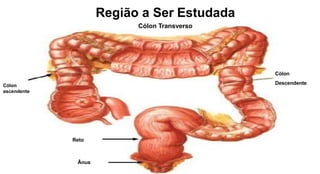 Cólon
ascendente
Reto
Ânus
Região a Ser Estudada
Cólon Transverso
Còlon
Descendente
 