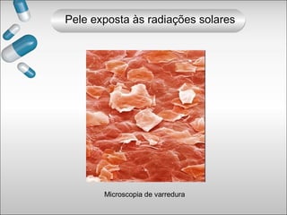 Pele exposta às radiações solares
Microscopia de varredura
 