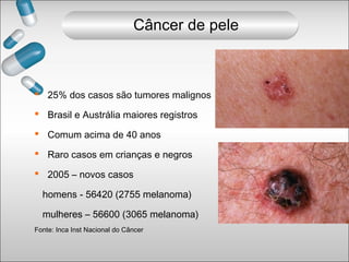  25% dos casos são tumores malignos
 Brasil e Austrália maiores registros
 Comum acima de 40 anos
 Raro casos em crianças e negros
 2005 – novos casos
homens - 56420 (2755 melanoma)
mulheres – 56600 (3065 melanoma)
Fonte: Inca Inst Nacional do Câncer
Câncer de pele
 