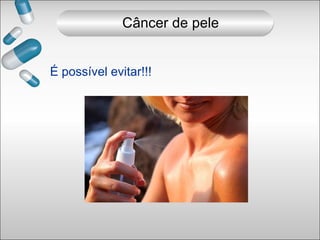 É possível evitar!!!
Câncer de pele
 