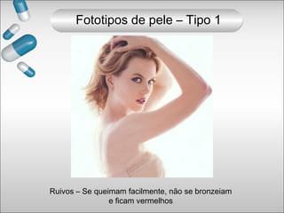 Ruivos – Se queimam facilmente, não se bronzeiam
e ficam vermelhos
Fototipos de pele – Tipo 1
 