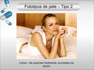 Loiros – Se queimam facilmente, bronzeiam-se
pouco
Fototipos de pele – Tipo 2
 