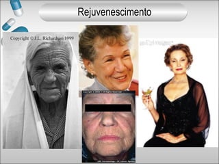 Rejuvenescimento
 