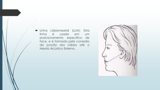  Linha Lábiomeatal (LLM): Esta
linha é usada em um
posicionamento específico de
face, e é formada pela conexão
da junção dos Lábios até o
Meato Acústico Externo.
 