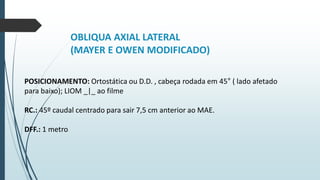 OBLIQUA AXIAL LATERAL
(MAYER E OWEN MODIFICADO)
POSICIONAMENTO: Ortostática ou D.D. , cabeça rodada em 45° ( lado afetado
para baixo); LIOM _|_ ao filme
RC.: 45º caudal centrado para sair 7,5 cm anterior ao MAE.
DFF.: 1 metro.
 