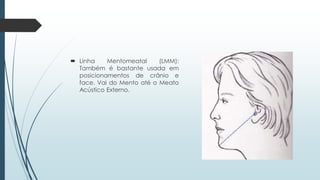  Linha Mentomeatal (LMM):
Também é bastante usada em
posicionamentos de crânio e
face. Vai do Mento até o Meato
Acústico Externo.
 