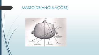 MASTOIDE(ANGULAÇÕES)
 