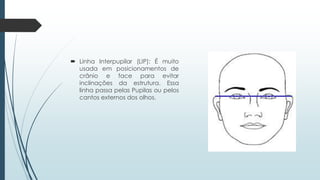  Linha Interpupilar (LIP): É muito
usada em posicionamentos de
crânio e face para evitar
inclinações da estrutura. Essa
linha passa pelas Pupilas ou pelos
cantos externos dos olhos.
 