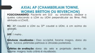 AXIAL AP (CHAMBERLAIM TOWNE,
WORMS BRETTON OU REVERCHON)
POSICIONAMENTO: Paciente em D.D ou ortostatica, abaixar o
queixo colocando a LOM ou LIOM perpendicular ao filme. PMS
alinhado a LCM/E..
RC: 30º caudal a LOM ou 37º caudal a LIOM, 6 cm acima da
glabela.
DFF: 1 metro .
Estruturas visualizadas : Osso occipital, forame magno, dorso da
sela turcica, pirâmides petrosas e clinoides posteriores.
Critérios de avaliação: dorso da sela e projetado dentro do
forame magno; todo crânio é visualizado.
 