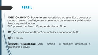 PERFIL
POSICIONAMENTO: Paciente em ortostático ou semi D.V., colocar a
cabeça em um perfil rigoroso, com o lado de interesse + próximo do
filme, corpo obliquado .
PMS paralelo ao filme. LIP perpendicular ao filme.
RC.: Perpendicular ao filme 2 cm anterior e superior ao MAE.
DFF.: 1 metro
Estruturas visualizadas: Sela turcica e clinoides anteriores e
posteriores e clivus.
 
