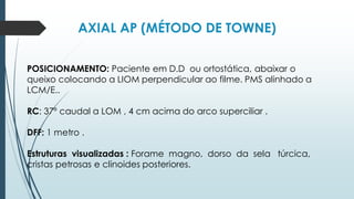 AXIAL AP (MÉTODO DE TOWNE)
POSICIONAMENTO: Paciente em D.D ou ortostática, abaixar o
queixo colocando a LIOM perpendicular ao filme. PMS alinhado a
LCM/E..
RC: 37º caudal a LOM , 4 cm acima do arco superciliar .
DFF: 1 metro .
Estruturas visualizadas : Forame magno, dorso da sela túrcica,
cristas petrosas e clinoides posteriores.
 