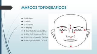 MARCOS TOPOGRAFICOS
 1- Glabela
 2- Násio
 3- Acântio
 4- Mento
 5- Canto Externo do Olho
 6- Canto Interno do Olho
 7- Margem Superior Orbital
 8- Margem Inferior Orbital
 