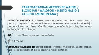 PARIETOACANTIAL(MÉTODO DE WATERS /
BLONDEAU / WALDRON / MENTO NASIO E
OCCIPITO-MENTONIANA )
POSICIONAMENTO: Paciente em ortostática ou D.V., estender o
pescoço, queixo contra o tampo da mesa. Ajustar a LMM esteja
perpendicular ao filme. Certificar-se que não haja rotação e ou
inclinação da cabeça.
RC.: _|_ ao filme, para sair no acântio.
DFF.: 1 metro.
Estruturas visualizadas: Borda orbital inferior, maxilares, septo nasal,
osso e arco zigomático, e espinha nasal anterior.
 