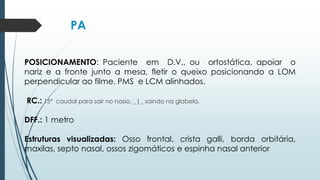 PA
POSICIONAMENTO: Paciente em D.V., ou ortostática, apoiar o
nariz e a fronte junto a mesa, fletir o queixo posicionando a LOM
perpendicular ao filme. PMS e LCM alinhados.
RC.: 15º caudal para sair no nasio, _|_ saindo na glabela.
DFF.: 1 metro
Estruturas visualizadas: Osso frontal, crista galli, borda orbitária,
maxilas, septo nasal, ossos zigomáticos e espinha nasal anterior
 