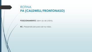 ROTINA
PA (CALDWELL/FRONTONASO)
POSICIONAMENTO: idem ao de crânio.
RC.: Perpendicular para sair no násio.
 