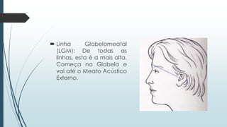 Linha Glabelomeatal
(LGM): De todas as
linhas, esta é a mais alta.
Começa na Glabela e
vai até o Meato Acústico
Externo.
 