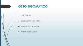 OSSO ZIGOMATICO
1-ROTINA:
 SUBMENTOVÉRTICE( HIRTZ),
 TANGENCIAL OBLIQUA e
 TOWNE MODIFICADO
 