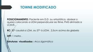 TOWNE MODIFICADO
POSICIONAMENTO: Paciente em D.D ou ortostática, abaixar o
queixo colocando a LIOM perpendicular ao filme. PMS alinhado a
LCM/E..
RC: 30º caudal a LOM, ou 37o à LIOM , 2,5cm acima da glabela
DFF: 1 metro .
Estruturas visualizadas : Arco zigomático
 