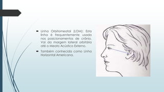  Linha Orbitomeatal (LOM): Esta
linha é frequentemente usada
nos posicionamentos de crânio.
Vai da margem lateral orbitária
até o Meato Acústico Externo.
 Também conhecida como Linha
Horizontal Americana.
 