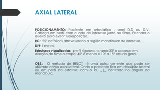 AXIAL LATERAL
POSICIONAMENTO: Paciente em ortostática , semi D.D ou D.V.
Cabeça em perfil com o lado de interesse junto ao filme. Estender o
queixo para evitar superposição.
RC.: 25º cefálicos atravessando a região mandibular de interesse.
DFF:1 metro.
Estruturas visualizadas: perfil rigoroso, o ramo;30º a cabeça em
direção do filme o corpo; 45º o mento e 10º a 15º estudo geral.
OBS.: O método de BELOT é uma outra vertente que pode ser
utilizada como axial lateral. Onde o paciente fica em decúbito lateral
ou em perfil na estativa, com o RC _|_ centrado no ângulo da
mandíbula.
 