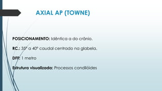 AXIAL AP (TOWNE)
POSICIONAMENTO: Idêntica a do crânio.
RC.: 35º a 40º caudal centrado na glabela.
DFF: 1 metro
Estrutura visualizada: Processos condilóides
 