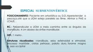 ESPECIAL SUBMENTOVÉRTICE
POSICIONAMENTO: Paciente em ortostática ou D.D.,hiperestender o
pescoço,até que a LIOM esteja paralela ao filme. Alinhar o PMS a
LCM/E. .
RC.: Perpendicular a LIOM a meio caminho entre os ângulos da
mandíbula. 4 cm abaixo da sínfise mandibular.
DFF.: 1 metro .
Estruturas visualizadas: Mandíbula, seios esfeinoidal e etmoidal,
processo mastóide , cristas petrosas , palato duro, forame magno
e osso occipital.
 