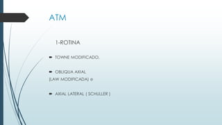 ATM
1-ROTINA
 TOWNE MODIFICADO,
 OBLIQUA AXIAL
(LAW MODIFICADA) e
 AXIAL LATERAL ( SCHULLER )
 
