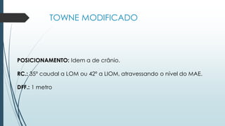 TOWNE MODIFICADO
POSICIONAMENTO: Idem a de crânio.
RC.: 35º caudal a LOM ou 42º a LIOM, atravessando o nível do MAE.
DFF.: 1 metro
 