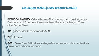 OBLIQUA AXIAL(LAW MODIFICADA)
POSICIONAMENTO: Ortostática ou D.V., cabeça em perfil rigoroso.
Posicionar a LIP perpendicular ao filme. Rodar a cabeça 15º em
direção ao filme.
RC.: 15º caudal 4cm acima do MAE.
DFF.: 1 metro
OBS.: Deverá ser feita duas radiografias, uma com a boca aberta e
outra com a boca fechada.
 