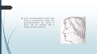  Linha Acantiomeatal (LAM): Esta
linha é comumente usada nos
posicionamentos de crânio e
face. Vai do Acântio até o
Meato Acústico Externo.
 