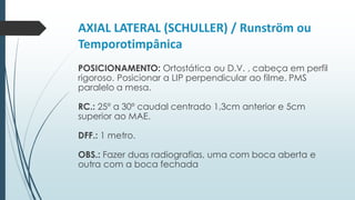 AXIAL LATERAL (SCHULLER) / Runström ou
Temporotimpânica
POSICIONAMENTO: Ortostática ou D.V. , cabeça em perfil
rigoroso. Posicionar a LIP perpendicular ao filme. PMS
paralelo a mesa.
RC.: 25º a 30º caudal centrado 1,3cm anterior e 5cm
superior ao MAE.
DFF.: 1 metro.
OBS.: Fazer duas radiografias, uma com boca aberta e
outra com a boca fechada
 