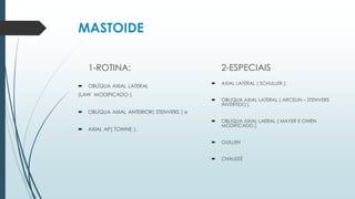 MASTOIDE
1-ROTINA:
 OBLÍQUA AXIAL LATERAL
(LAW MODIFICADO ),
 OBLÍQUA AXIAL ANTERIOR( STENVERS ) e
 AXIAL AP( TOWNE ).
2-ESPECIAIS
 AXIAL LATERAL ( SCHULLER );
 OBLIQUA AXIAL LATERAL ( ARCELIN – STENVERS
INVERTIDO ),
 OBLIQUA AXIAL LAERAL ( MAYER E OWEN
MODIFICADO ).
 GUILLEN
 CHAUSSÉ
 