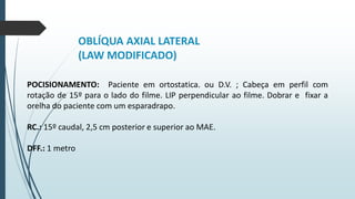 OBLÍQUA AXIAL LATERAL
(LAW MODIFICADO)
POCISIONAMENTO: Paciente em ortostatica. ou D.V. ; Cabeça em perfil com
rotação de 15º para o lado do filme. LIP perpendicular ao filme. Dobrar e fixar a
orelha do paciente com um esparadrapo.
RC.: 15º caudal, 2,5 cm posterior e superior ao MAE.
DFF.: 1 metro
 