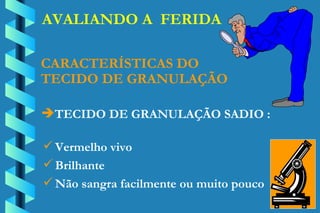 AVALIANDO A  FERIDA TECIDO DE GRANULAÇÃO SADIO : CARACTERÍSTICAS DO TECIDO DE GRANULAÇÃO Vermelho vivo Brilhante Não sangra facilmente ou muito pouco 