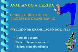 AVALIANDO A  FERIDA TECIDO DE GRANULAÇÃO DOENTE : CARACTERÍSTICAS DO TECIDO DE GRANULAÇÃO Vermelho escuro Sem brilho ou ressecado Sangra com abundância 