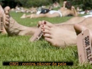 ONG - contra câncer de pele
 