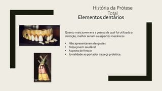 História da Prótese
Total
Elementos dentários
Quanto mais jovem era a pessoa da qual foi utilizada a
dentição, melhor seriam os aspectos mecânicos
• Não apresentavam desgastes
• Polpa jovem saudável
• Aspecto de frescor
• Jovialidade ao portador da peça protética.
 