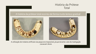 História da Prótese
Total
A história da prótese total ocorreu de forma muito lenta e gradual
http://www.swissedent.co.uk/denture-blog/the-history-of-dentures-from-700-bce-to-2015
A utilização de molares artificiais nas peças era impossível, já que durante o ato da mastigação
causavam dores
 