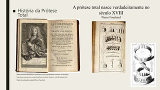 ■ História da Prótese
Total
https://museumofhealthcare.wordpress.com/2013/03/08/the-evolution-of-dentistry/
https://www.sciencesource.com/archive/Pierre-Fauchard--Dentures--1728-SS21569700.html
https://en.wikipedia.org/wiki/Pierre_Fauchard
A prótese total nasce verdadeiramente no
século XVIII
Pierre Fouchard
 