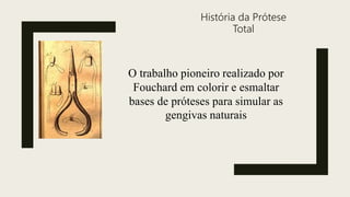 História da Prótese
Total
O trabalho pioneiro realizado por
Fouchard em colorir e esmaltar
bases de próteses para simular as
gengivas naturais
 