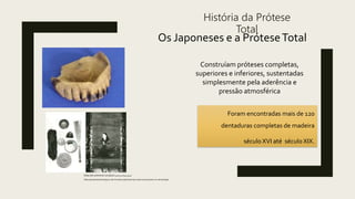 História da Prótese
Total
Os Japoneses e a PróteseTotal
https://br.pinterest.com/pin/225461525065927944/
Construíam próteses completas,
superiores e inferiores, sustentadas
simplesmente pela aderência e
pressão atmosférica
Foram encontradas mais de 120
dentaduras completas de madeira
século XVI até século XIX.
https://proteseodontologica.odo.br/index.php/historia/3-historia-da-protese-na-odontologia
 